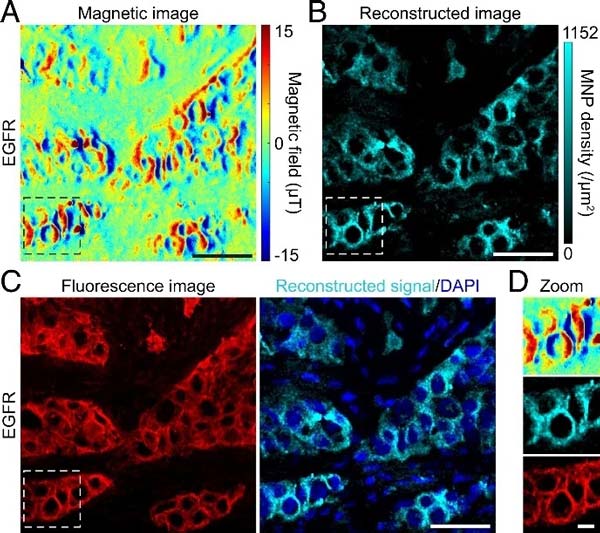 applications-nvcenter-cell-research-lung-cancer-tissu