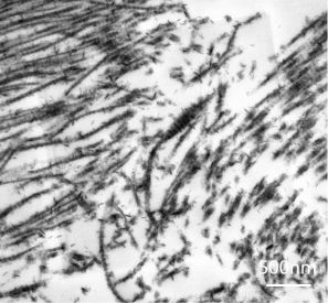 sem image analysis Renal Pathology Sections