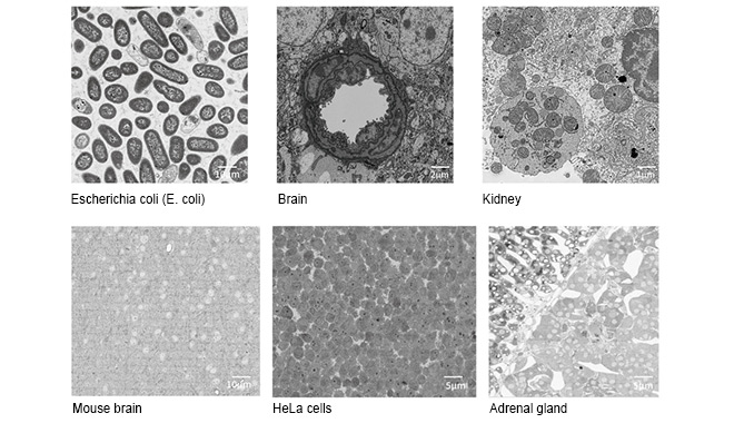 Reconstruction 3D haute vitesse et haute résolution : la solution de microscopie électronique volumétrique CIQTEK ouvre de nouvelles perspectives en matière de caractérisation biologique.